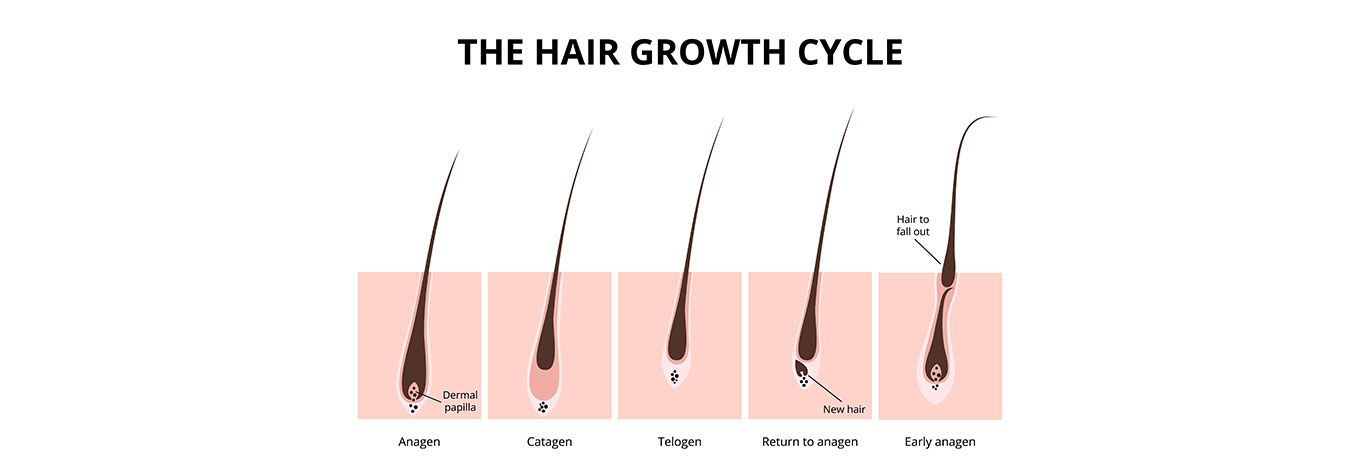 Hair Restoration