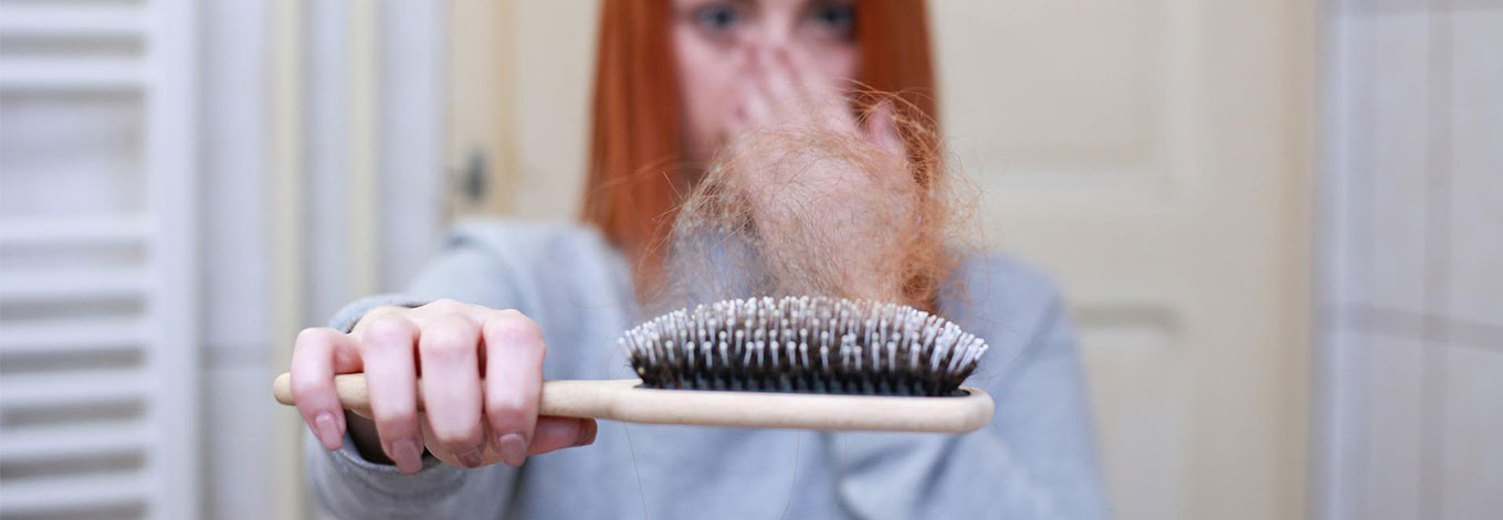 Female Pattern Hair Loss and Treatment Options | hair thinning, hair loss  women