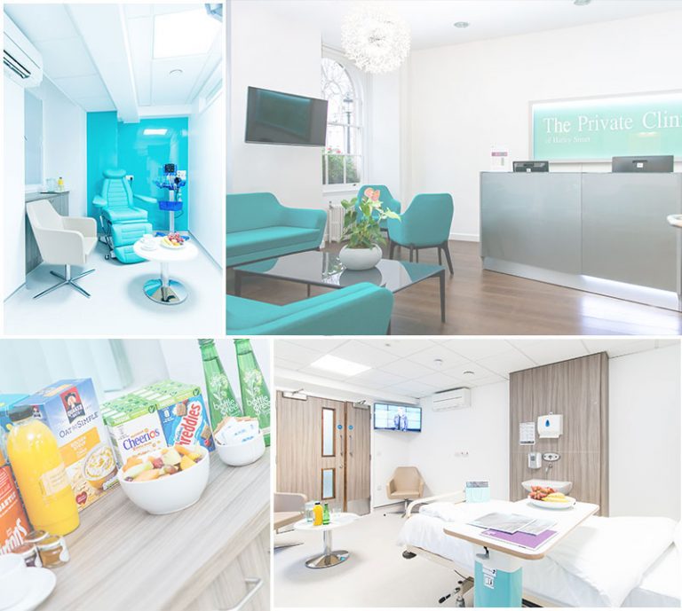 the fitzroy hospital private clinic theatre plastic surgery liposuction facility overnight daycase theatre 768x689 1