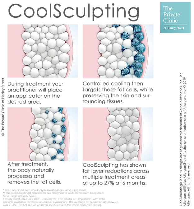 Coolsculpting fat freezing how does it work crylipolysis the private clinic
