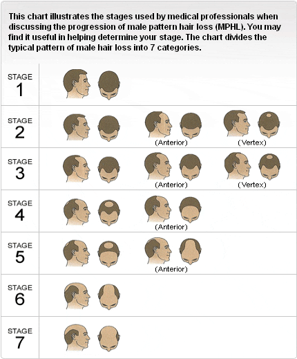 Norwood chart