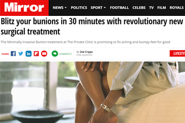 blitz your bunions 30 minute revolutionary bunion surgical removal treatment