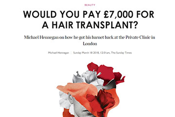 hair loss balding would you pay for a fue hair transplant the private clinic