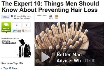 news 10 things men should know about preventing hair loss the private clinic