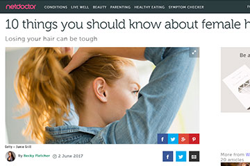 news 10 things you should know about female hair loss