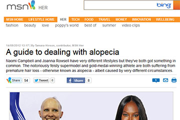 news a guide to dealing with alopecia the private clinic