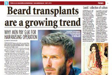 news beard transplants are a growing trend the private clinic