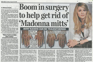 news boom in surgery to help get rid of madonna mitts the private clinic
