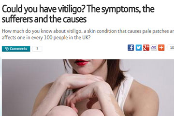 news could you have vitiligo the symptoms the sufferers and the causes the private clinic