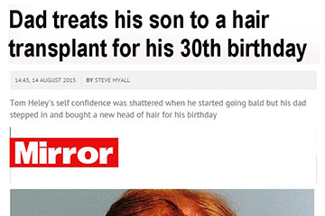 news dad treats his son to a hair transplans for his 30th birthday the private clinic