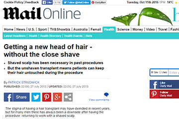 news getting a new head of hair without the close shave the private clinic