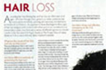 news hair loss the private clinic