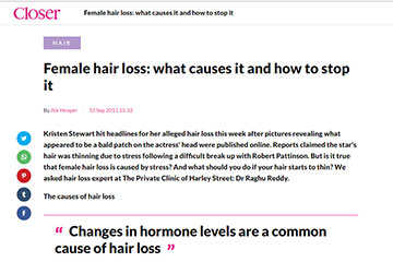 news hair loss what causes it and how to stop it the private clinic