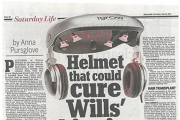 news helmet that could cure prince williams thinning crown the private clinic