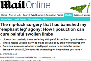 news how liposuction can cure painful swollen limbs the private clinic