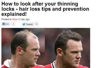 news how to look after your thinning locks hair loss tips and prevention explained the private clinic