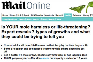 news is your mole harmless or life threatening the private clinic