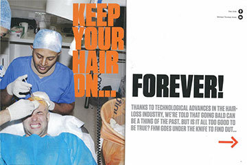 news keep your hair on forever the private clinic