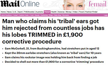 news man who claims his tribal ears got him rejected from countless jobs has his lobes trimmed in 1900 corrective procedure