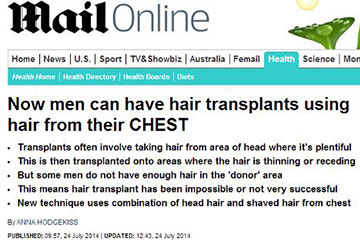 news now men can have hair transplants using hair from their chest the private clinic