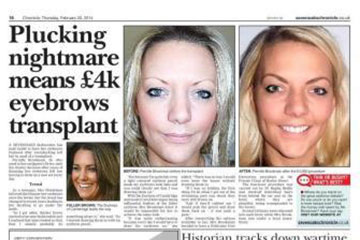 news plucking nightmare means 4k eyebrow transplant the private clinic