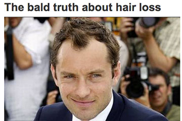 news the bald truth about hair loss the private clinic