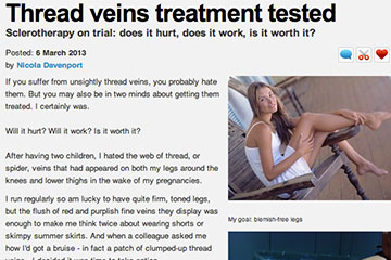 news thread veins treatment tested the private clinic