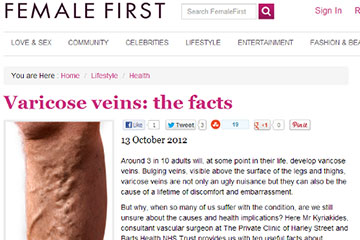 news varicose veins the facts the private clinic