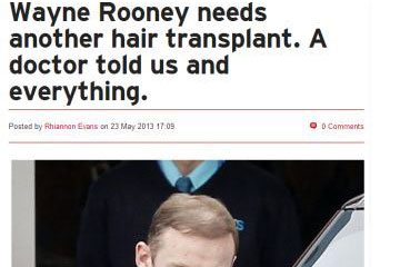 news wayne rooney needs another hair transplant the private clinic