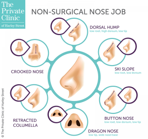 non surgical rhinoplasty