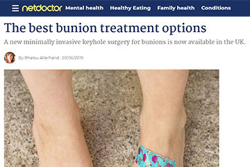 the best bunion treatment options minimally invasive keyhole surgery for bunions uk london