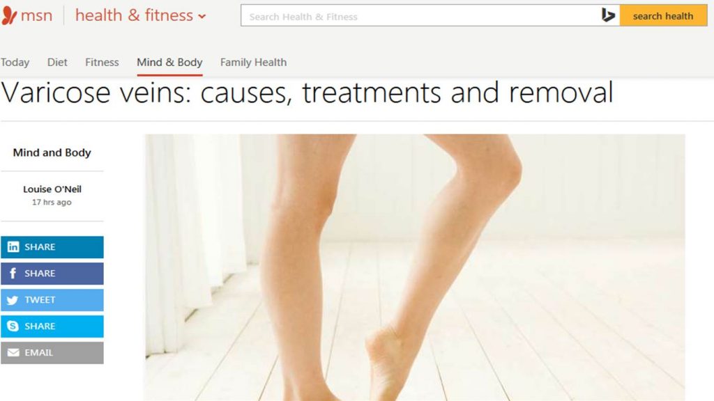 varicose veins causes treatment removal msn 1024x576 1