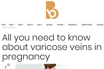 varicose veins pregnancy treatments evla