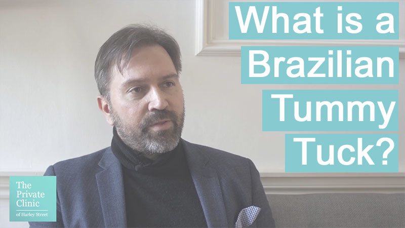 what is the brazilian tummy tuck abdomnioplasty technique