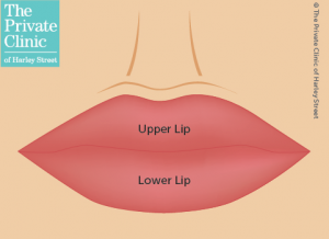 lip-filler-upper-lower-lip-enhancement-volume-300×218-1.png