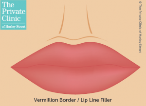 lip-filler-vermillion-border-lip-line-definition-enhancement-300×218-1.png