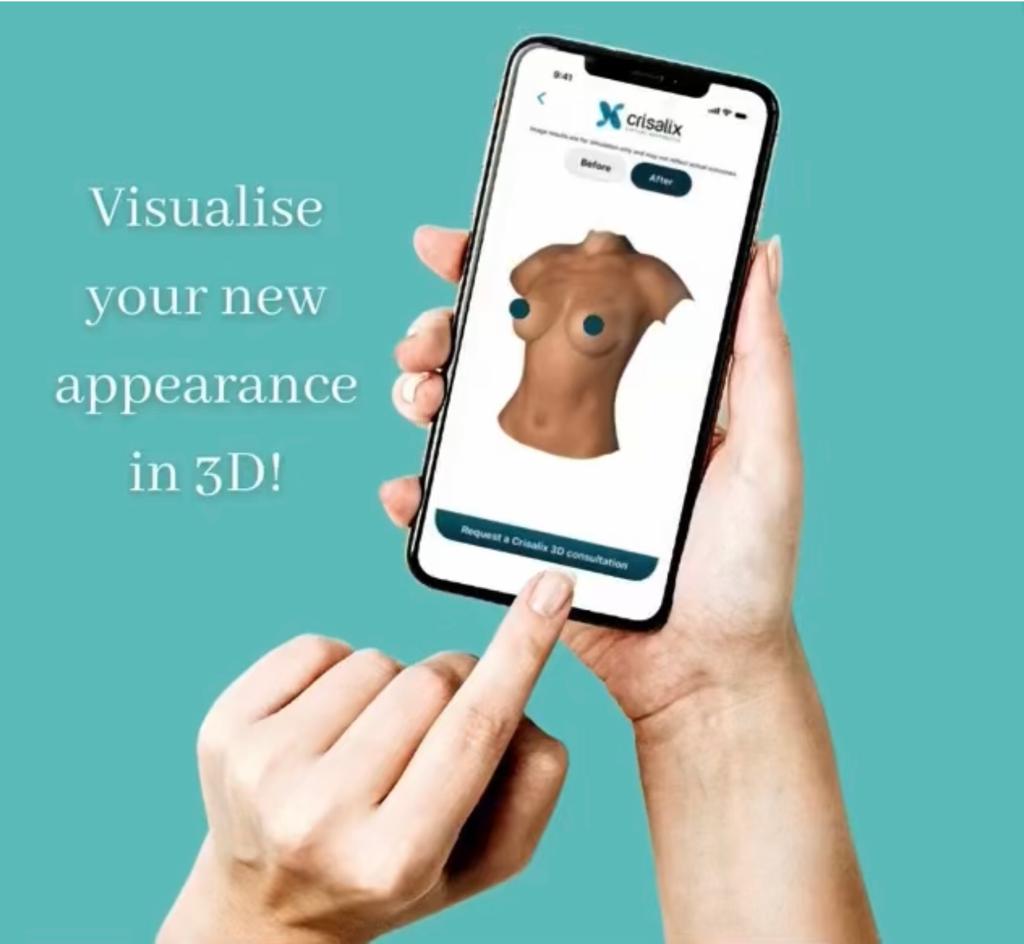 Breast augmentation 3D simulator