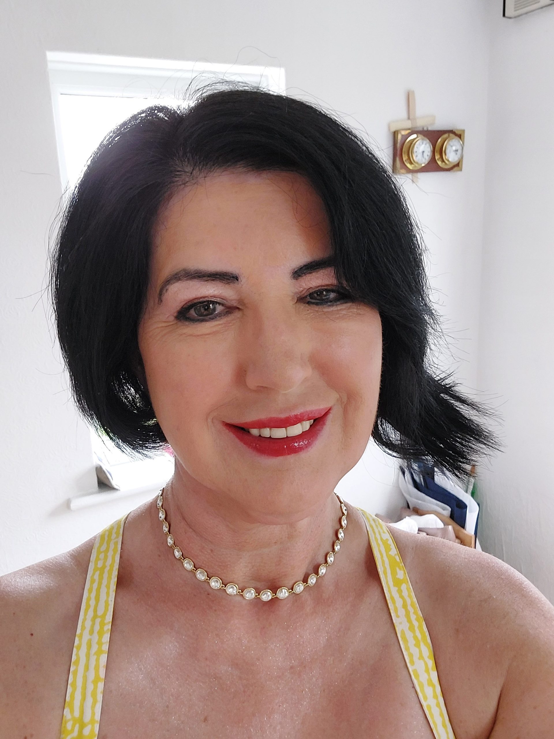 upper eyelid surgery patient review