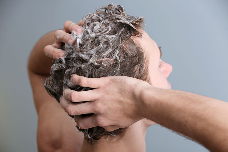 fue-hair-transplant-aftercare-when-can-i-wash-hair