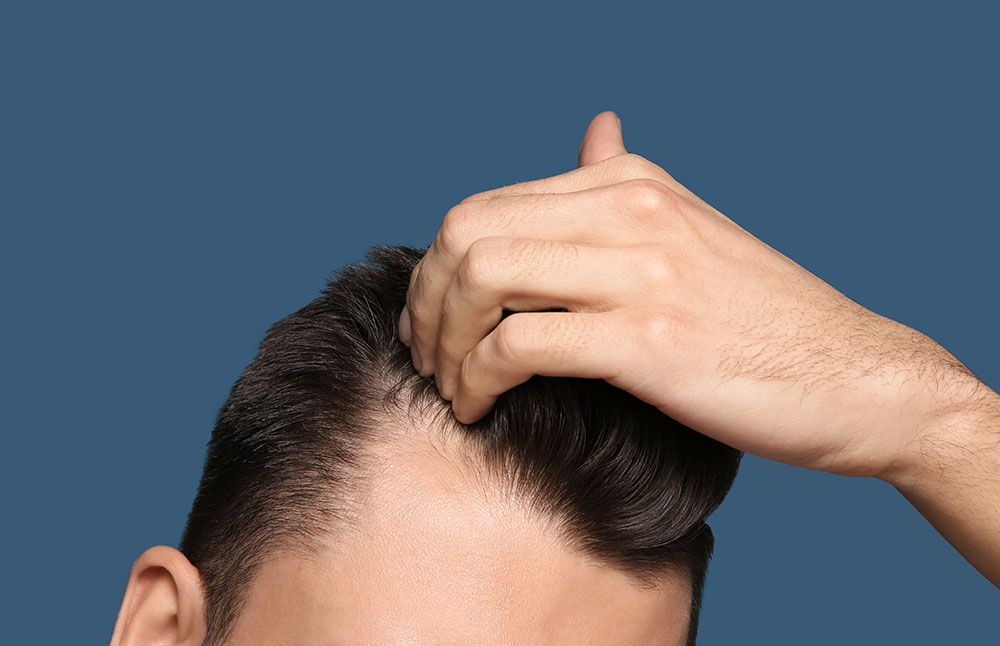 hair-loss-consultation-fue-hair-transplant-expert-surgeons-london-leeds-manchester-northampton-birmingham