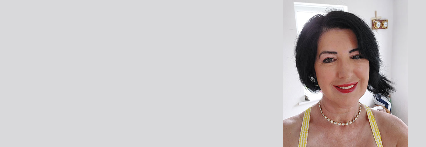 Blepharoplasty Upper Eyelid Surgery Patient Review