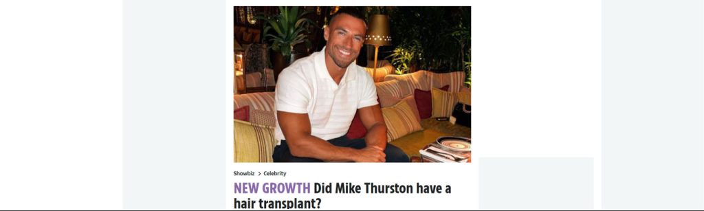 Mike Thurston Hair Transplant at The Private Clinic of Harley Street Results