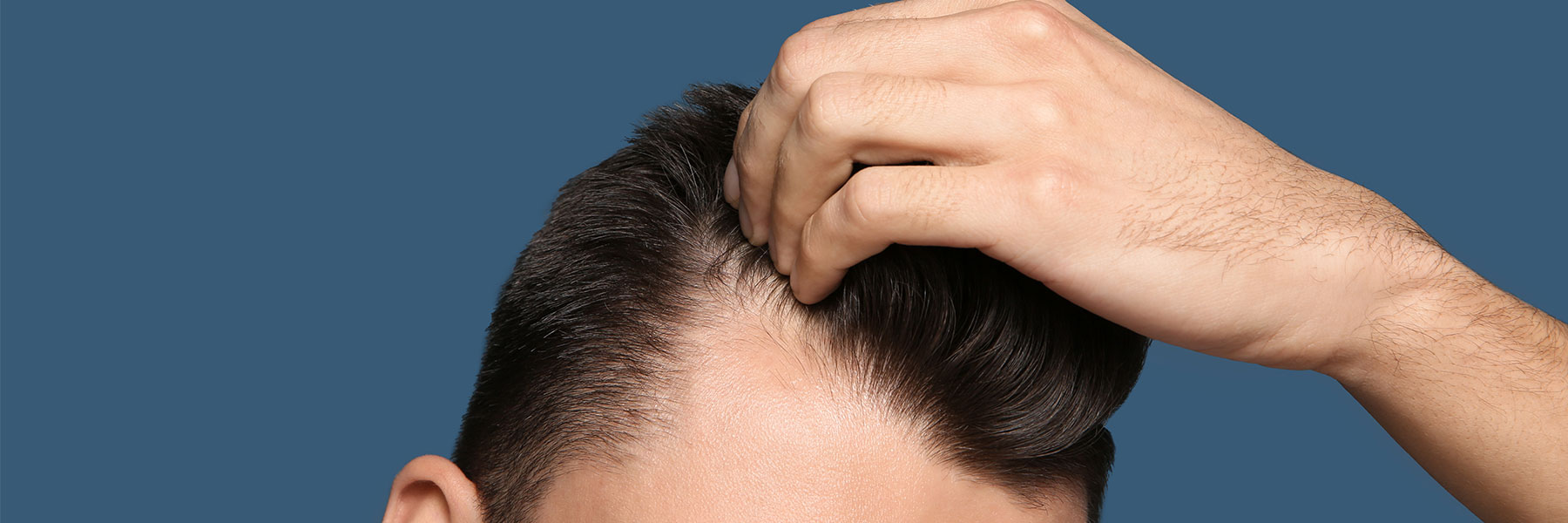Hair transplant Before After Photos 2022, Pre-op and Post-op Results Hair Transplants Hair transplant Before After Photos 2022, Pre-op and Post-op Results Hair Transplants