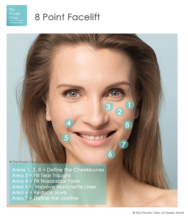 8 point facelift treatment areas