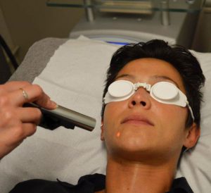 Acne-N-Lite-laser-treatment-Dina-copy-WEB