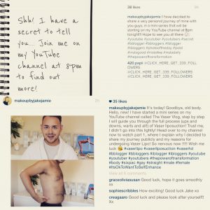 Collage - Shh! - It's today! - Jake Jamie VASER Lipo