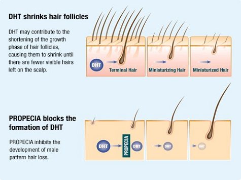 The Pros and Cons of Hair Loss Medication, including the Side Effects