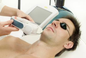 IPL Photorejuvenation machine and face model