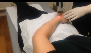 Laser-hair-removal-the-private-clinic-Nikola