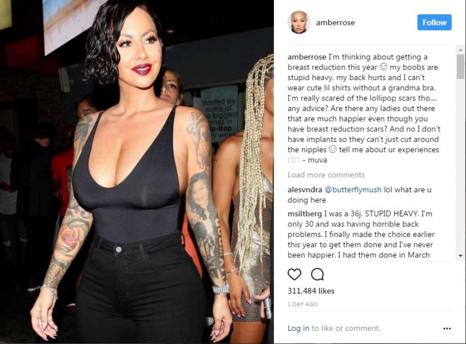 amber rose breast reduction the private clinic